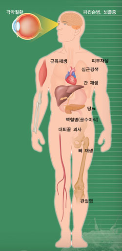 줄기세포의 종류와 치료 전망^줄기세포는 우리 몸의 모든 세포로 변할 수 있는 만능세포다. 크게 성체줄기세포와 배아줄기세포로 나뉜다. 성체줄기세포는 몸 안에서 암세포로 변할 가능성이 적고 윤리 문제가 없지만 분화 능력이 떨어진다. 배아줄기세포는 분화 능력이 뛰어나지만 난자나 냉동 배아를 이용하기 때문에 윤리 문제가 있다. 현재 실용화 시기는 성체 줄기세포가 좀더 가깝다. 그림은 줄기세포 치료가 유망한 분야다.