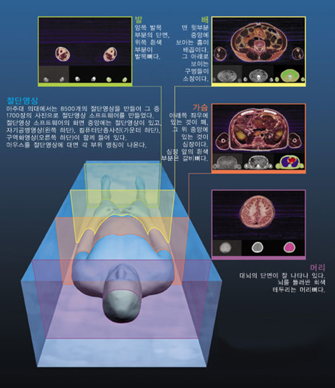 절단 전에 시신을 굳히는 것을 '포매'라고 한다. 나무 포매상자 안에 시신을 놓고 젤라틴 성분의 포매제를 넣어 굳힌다. 조직의 강도를 높이기 위해 냉각(-50℃)후 절단한다.