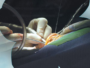 달팽이관에 전극을 삽입해 소리를 들을 수 있는 인공 와우 수술은 청각장애인에게 희망을 주고 있다.