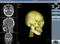 첨단의료영상^치아를 교정하기 전에 디지털 3차원 MRI, 3차원 컴퓨터 단층촬영을 이요해 부정교합의 원인을 정밀하게 찾는다.