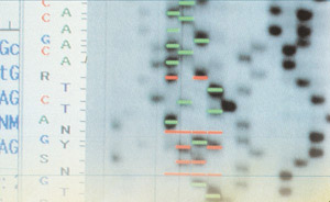 21세기 의학과 생명과학에 혁명을 일으키고 있는 인간게놈지도는 1895년 발견된 X선을 이용해 DNA 구조를 밝힌 덕분에 완성될 수 있었다. 사진은 인간게놈지도의 염기서열을 분석한 자료.