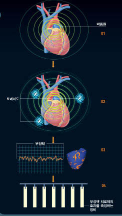 박동원이 만든 정상적인 전기자극이 심장을 움직인다(01). 심장에 이상이 생기면 심실 표면에‘토네이도’가 일어나 박동원을 교란시킨다(02). 심장이 부정맥에 빠지면서 기능을 멈춘다(03). 토네이도의 발생과 확산 과정을 분석하면 효과가 가장 좋은 부정맥 치료제를 찾을 수 있다(04).