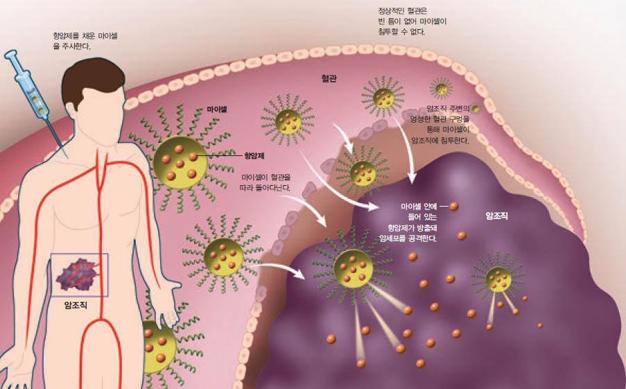 마이셀이 암조직을 찾아가는 원리^수십~100nm 크기의 공 모양인 마이셀은 암조직 주변의 엉성한 혈관 틈으로 암조직에 침투해 속에 넣어 둔 항암제를 방출한다.