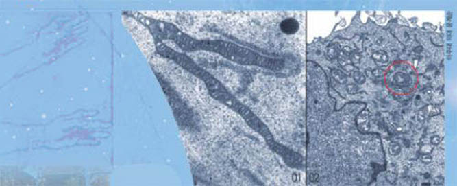 0102미토콘드리아를 전자현미경으로 촬영한 사진. 늙어 기능이 떨어지고 끝부분이 터진 듯 보이는 미토콘드리아(01)와 달리 동그란 미토콘드리아(빨간 원)는 활발히 작용하고 있다(02).