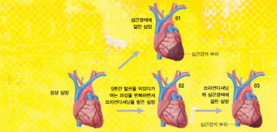 프리컨디셔닝의 효과^관상동맥을 흐르는 혈액의 양이 줄면 산소가 부족해 심장근육이 파괴(어두운 부분)된다(01). 그런데 프리컨디셔닝으로 산소가 부족한 상황을 미리 경험시키면(02) 심근경색에 걸릴 때 근육이 파괴되는 양이 줄어든다(03).