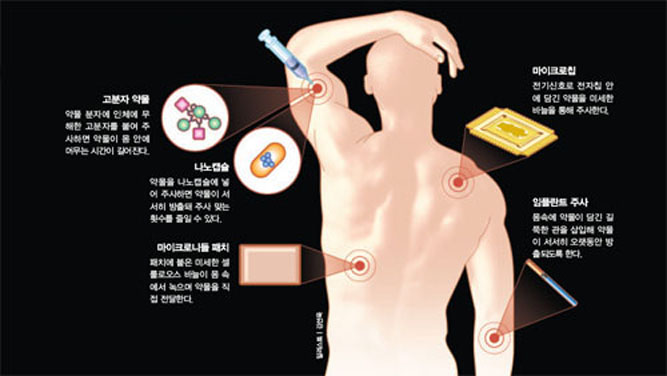 주사기 공포를 덜어주는 약물전달시스템^약물이 몸 안에 머무는 시간을 늘려 주사 맞는 회수르 줄이거나 미세한 바늘을 이용해 통증을 줄인다. 몸속에 삽입하는 약물전달시스템도 개발됐다.