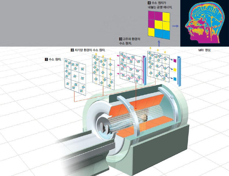 MRI의 촬영원리^MRI는 몸속 특정 원소(주로 수소를 이용)의 공명 에너지 차이를 영상으로 구현한다. 몸속 부위마다 수소 원자의 밀도가 다르다(1). 자기장을 약 3테슬라 강도로 걸면 수소 원자핵이 같은 방향으로 정렬된다(2). 고주파를 쏘면 수소 원자핵이 공명한다(3). 고주파를 멈추면 수소 원자가 원래 상태로 돌아오는데 이때 내보내는 신호를 분석해 영상을 만든다(4).