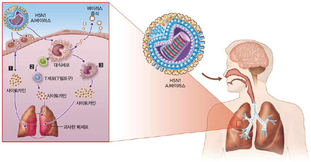 AI바이러스와 폐포 괴사^사람은 기관지 상피세포와 폐포에 인플루엔자 바이러스 수용체가 있다. 수용체에 AI바이러스가 결합하면‘적’을 죽이는 사이토카인이 분비되거나(1) 바이러스를 잡아먹는 대식세포가 활성화된다. 대식세포는 T림프구를 활성화해 면역반응을 일으키고(2), 자기 스스로 사이토카인을 내놓는다(3). 사이토카인은 세포를 죽이는 기능을 하는 단백질인데, AI바이러스에 감염돼 사이토카인의 양이 늘어나면 폐포가 괴사한다. 심하면 목숨을 잃을 수도 있다.