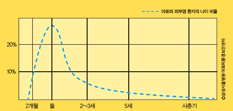 아토피 피부염은 주로 돌 쯤에 심해지다가 나이가 들며 증세가 차츰 나아지는 특성이 있다.