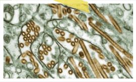 H5N1형 조류인플루엔자 바이러스의 현미경 사진. 2003년부터 2011년까지 총 4번 우리나라에 발생한 조류인플루엔자는 모두 H5N1형이었다.