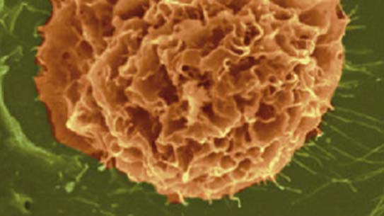 전암세포 단계에서 관찰된 세포 표면의 프랙탈 무늬.