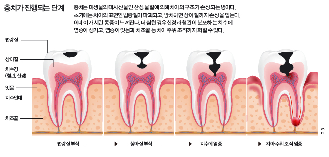 height:317px; width:662px