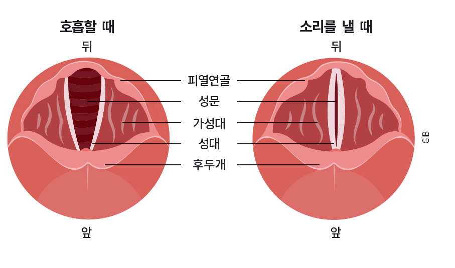 height:295px; width:500px